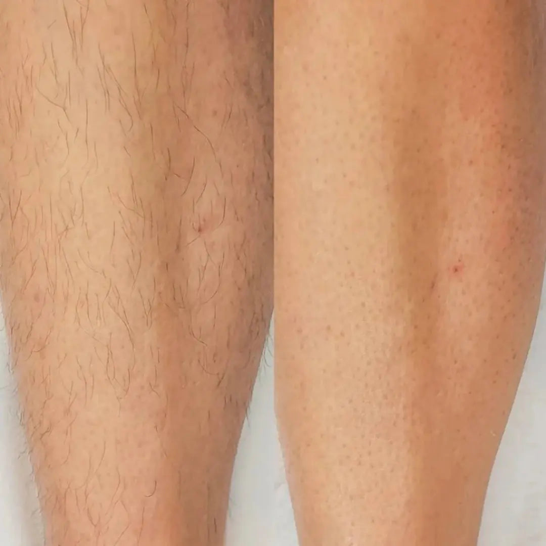 Velvet™ - 2-in-1 Painless Hair Trimmer